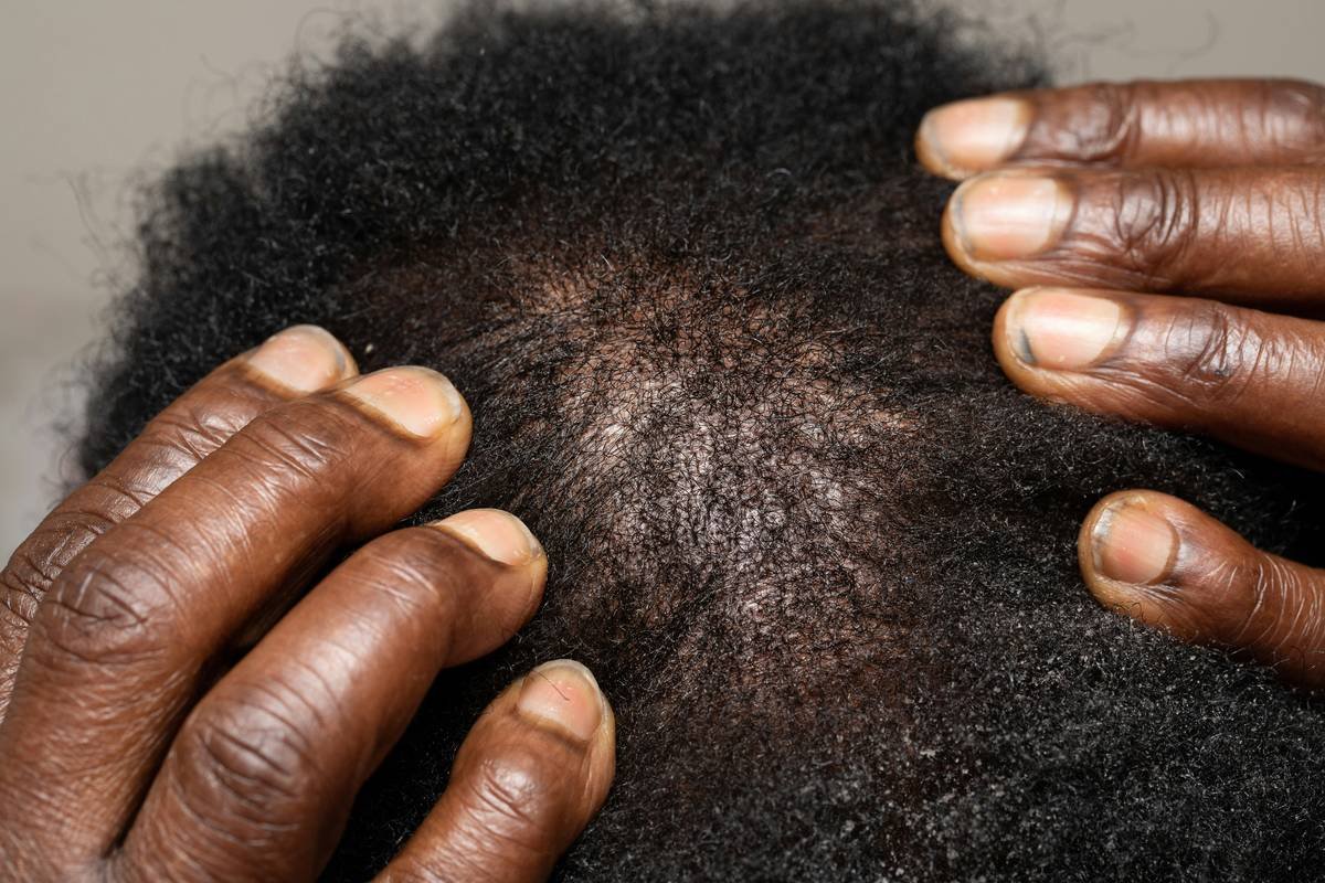 Why Your Scalp Care Brush Might Be the Secret Weapon You’ve Been Missing